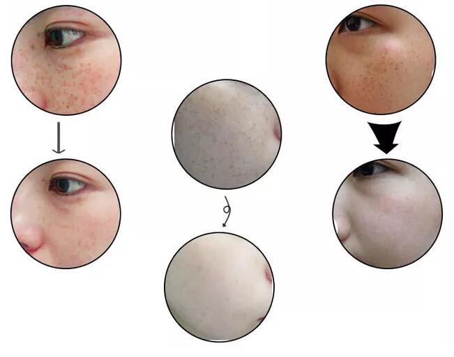 黑臉娃娃的危害都有哪些？