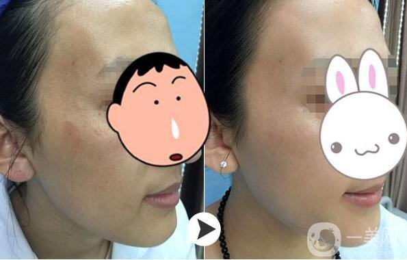 為什么眾多明星都鐘愛*？