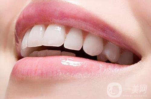 矯正牙齒的*佳年齡 矯正牙齒的利與弊