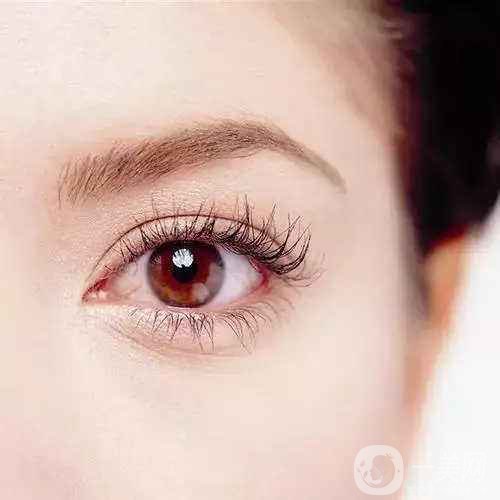 內雙怎么變外雙 全切雙眼皮可以嗎