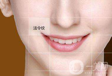 玻尿酸去法令紋手術(shù)價(jià)格 *果好不好