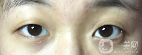 整容整得好看是怎樣一種體驗(yàn)？眾知乎美女回答讓你羨慕嫉妒恨！