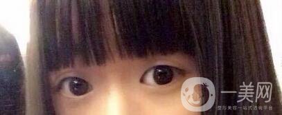 整容整得好看是怎樣一種體驗(yàn)？眾知乎美女回答讓你羨慕嫉妒恨！