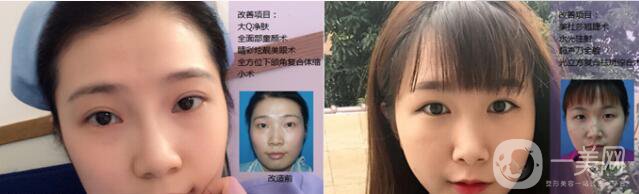 中山美南華醫(yī)院怎么樣 優(yōu)惠整形價格表一覽