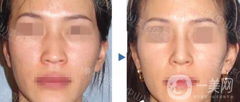 中山美南華醫(yī)院怎么樣 優(yōu)惠整形價格表一覽