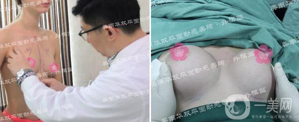 中山美南華醫(yī)院怎么樣 優(yōu)惠整形價格表一覽