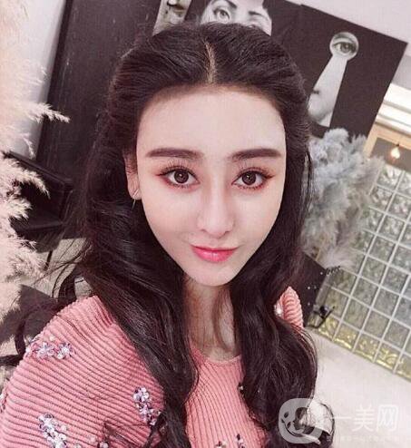 又一個(gè)整容失敗的女明星，鼻子都整歪了，不甘心揚(yáng)言還要植發(fā)！