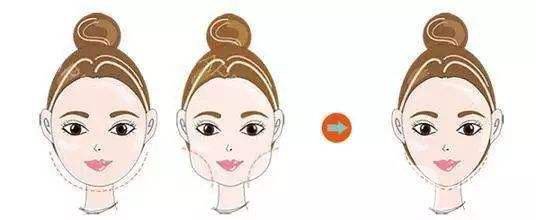 深圳做個(gè)臉部抽脂多少錢 *果好不好