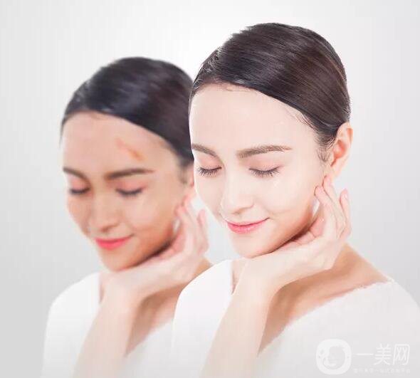 增生疤痕注意事項(xiàng)有哪些？該如何預(yù)防及調(diào)節(jié)？