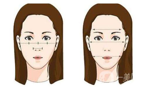 面部磨顴骨術(shù)后恢復(fù)要多久 磨顴骨*嗎