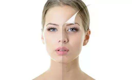 彩光嫩膚的危害 彩光嫩膚的優(yōu)勢(shì)