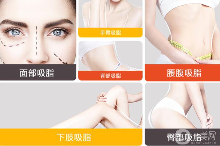 關(guān)于吸脂術(shù)的10個常見問題解答