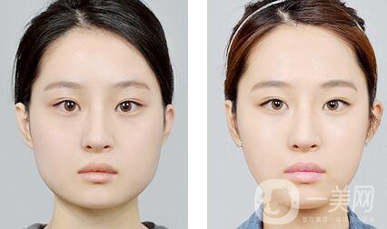 *注意事項(xiàng)