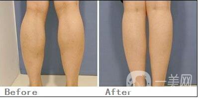 **價格,**注意事項