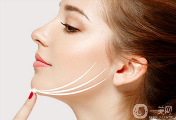 自體脂肪能墊下巴嗎？*果如何？會不會很貴？