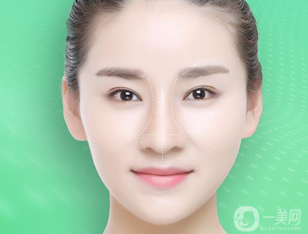 北京鼻骨矯正術(shù)多少錢 鼻骨矯正會留疤痕嗎