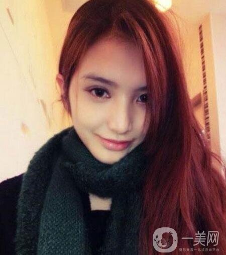 下頜整形手術(shù)的方法有哪些？