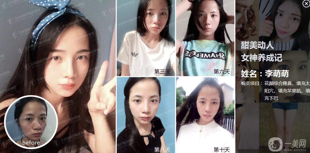 成都武侯區(qū)艾米麗醫(yī)療美容門診部