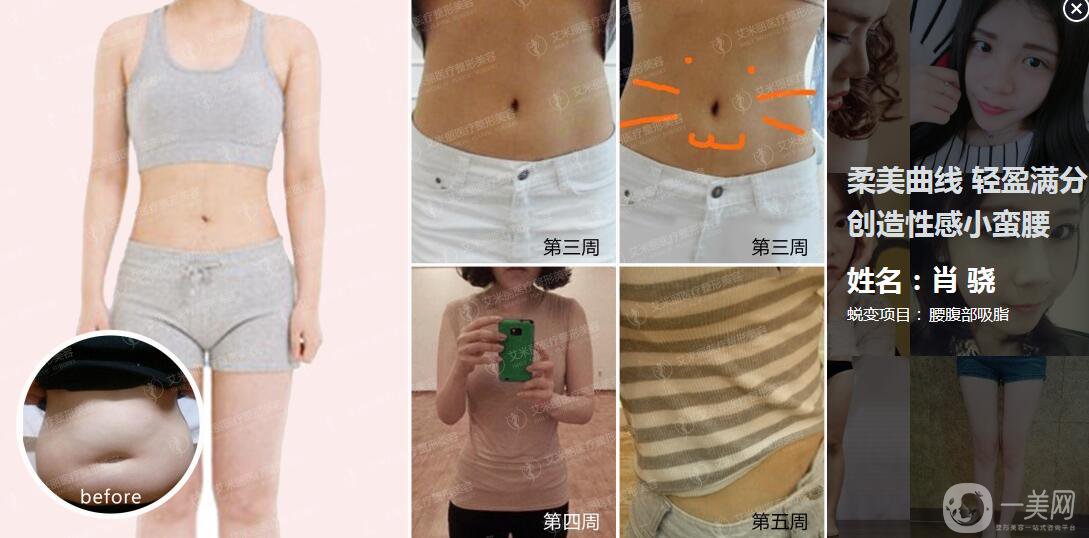 成都武侯區(qū)艾米麗醫(yī)療美容門診部