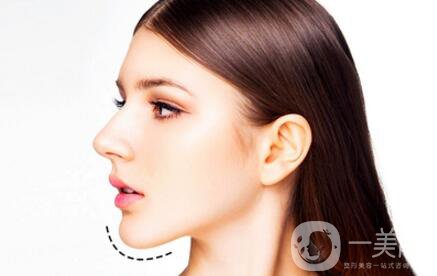 自體脂肪墊下巴恢復(fù)期是怎樣的？如何做好術(shù)后護(hù)理？