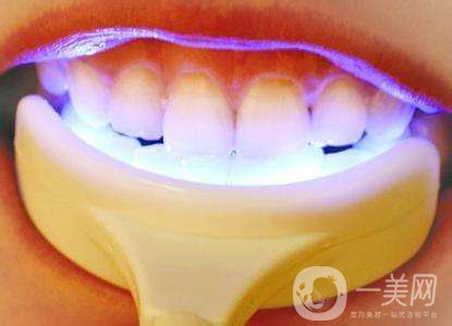 冷光美白牙齒的價(jià)格 冷光美白牙齒持久嗎