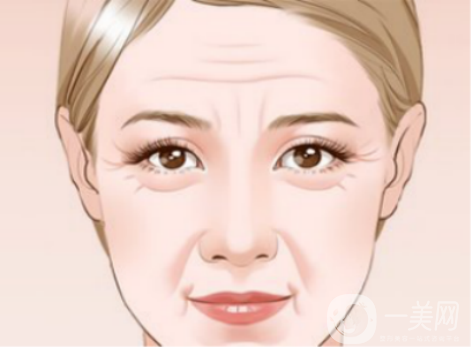 去皺多少錢 去皺費(fèi)用是多少 祛皺的方法