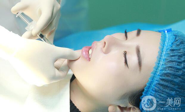 自體脂肪墊下巴貴嗎 一般多少錢？