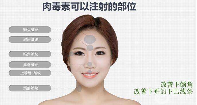 什么是* *對我合適嗎