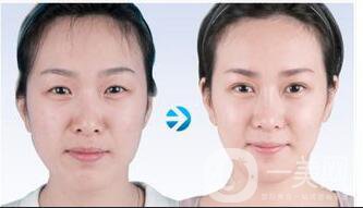 上海削骨多少錢,上海削骨費(fèi)用