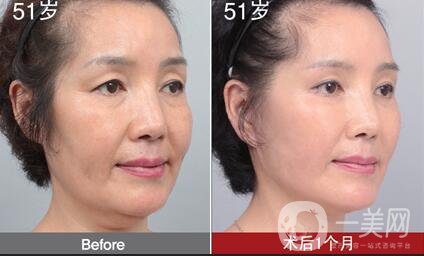 熱瑪吉和超生刀信息介紹,熱瑪吉和超生刀區(qū)別