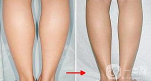 打*多少錢,*價格盤點