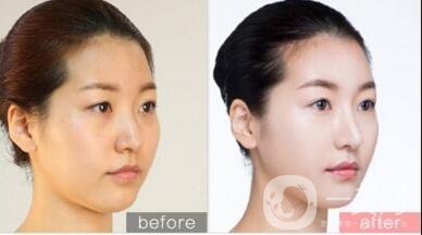 黑臉娃娃*果照,黑臉娃娃價(jià)格