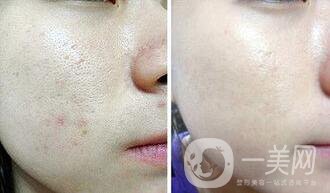 黑臉娃娃*果照,黑臉娃娃價(jià)格