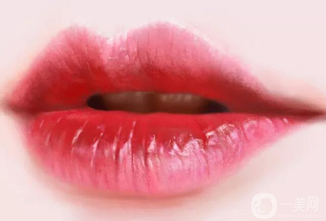 豐唇手術(shù)好嗎 有哪些手術(shù)方式呢？