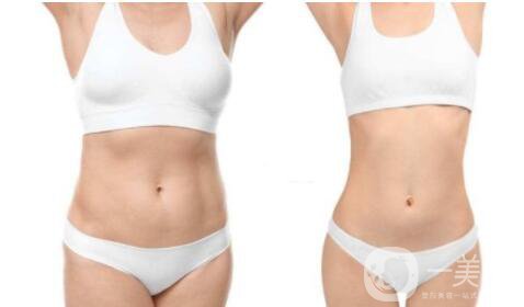 抽脂減肥價(jià)格一覽表 抽脂減肥有危害嗎