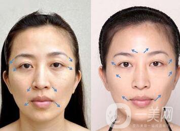 第四代熱瑪吉*果,第四代熱瑪優(yōu)勢