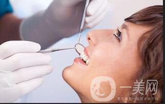 光固化樹脂補(bǔ)牙價格