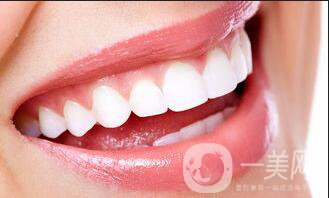 光固化樹脂補(bǔ)牙價格