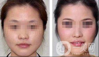 *價(jià)格,*費(fèi)用