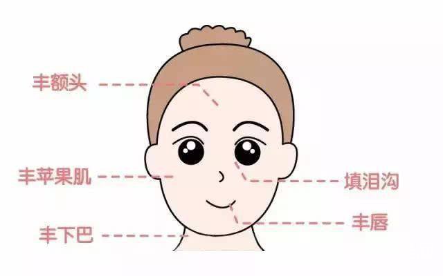 自體脂肪填充額頭貴嗎 自體脂肪填充額頭好不好