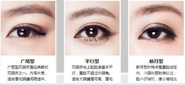 腫泡眼雙眼皮貴嗎 腫泡眼雙眼皮手術(shù)的價(jià)格