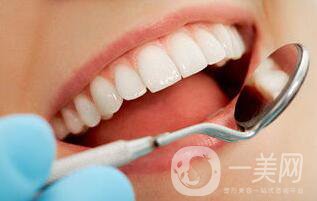 美容牙多少錢一顆