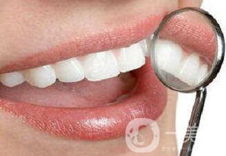 種植牙和鑲牙哪個更好