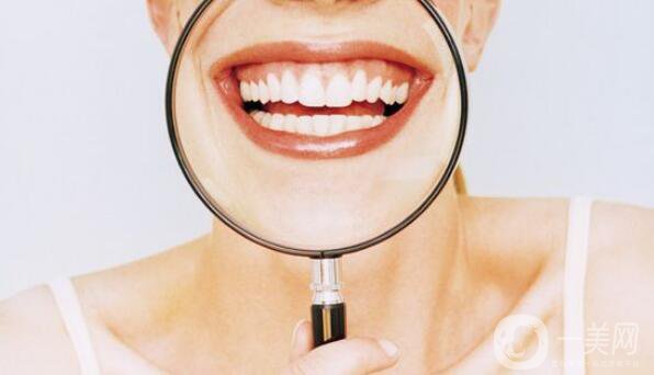 烤瓷牙種類及價(jià)格 你知道多少?