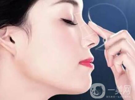 非手術(shù)隆鼻多少錢,非手術(shù)隆鼻*果自然嗎