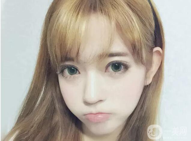 什么眼皮不能割雙眼皮手術 割雙眼皮注意事項