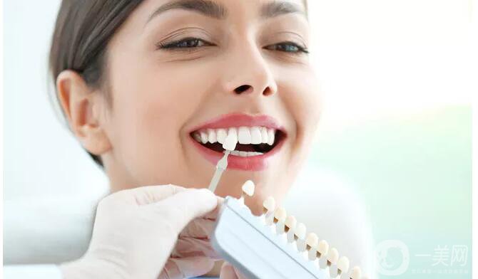 美容冠修復(fù)多少錢 美容冠修復(fù)*果怎么樣