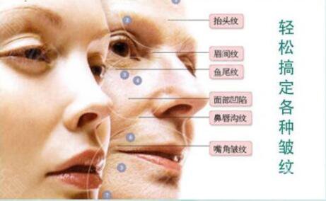 整容手術(shù)要多久時間 整容手術(shù)風(fēng)險有多大