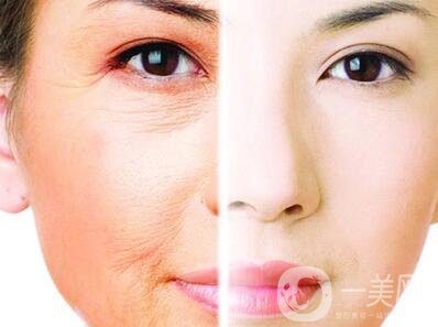 光子嫩膚的原理