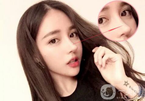 歪鼻矯正手術(shù)是怎樣的 手術(shù)方法有哪些？